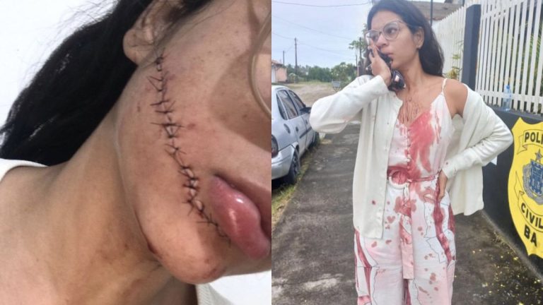 #Bahia: Jovem  sofre facada no rosto enquanto dormia dentro de ônibus